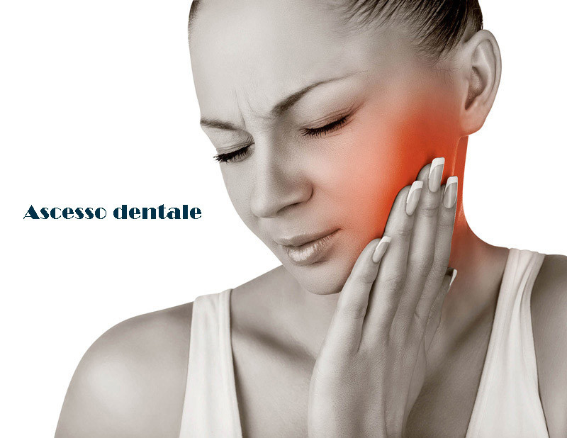 Ascesso dentale sintomi