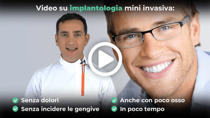 implantologia a carico immediato video 